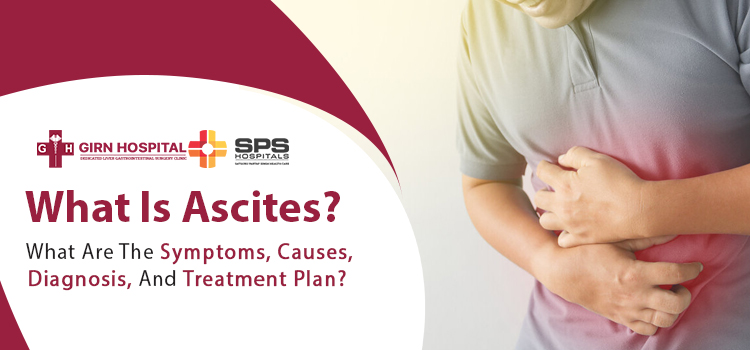What-is-Ascites-What-are-the-symptoms,-causes,-diagnosis,-and-treatment-plan