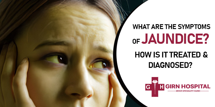 What are the symptoms of jaundice? How is it treated and diagnosed?