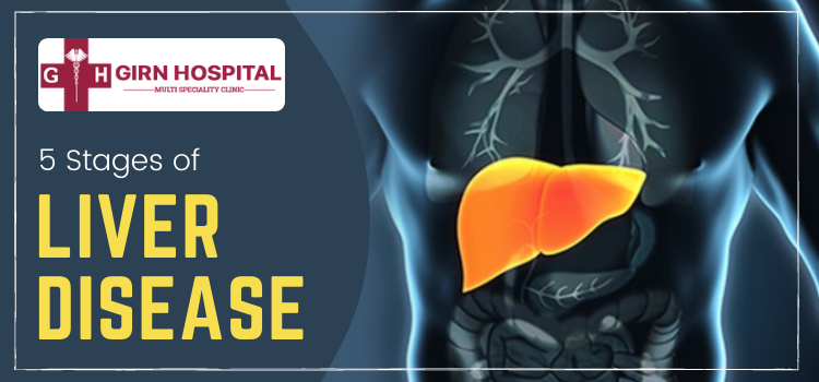 Breakdown of the stages of liver disease from the renowned Hepatologist